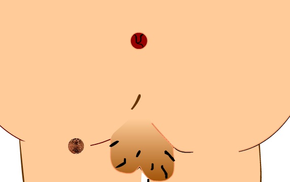 Penny